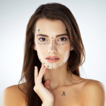 Woman with marks on her face getting ready for a surgical facelift